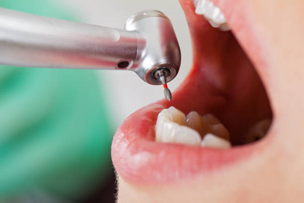 Best Cracked Tooth Emergency Dentist  in Oakdale, LA